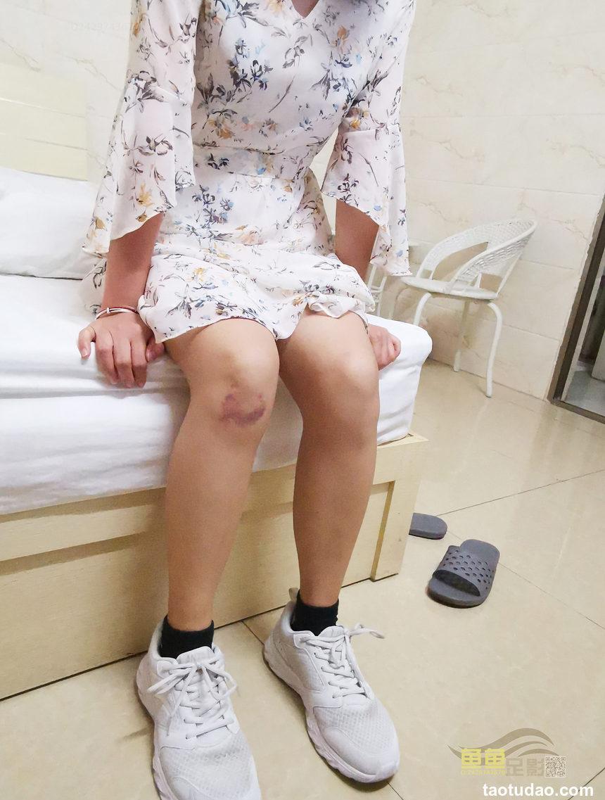 鱼鱼足影 NO.040 - 慧婷[113P+1V／505MB]